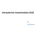 Intrauterine Insemination IUI