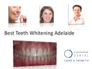 Best teeth whitening adelaide