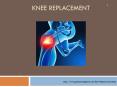 A PPT on Knee Replacement by Jyotinursinghome|Best orthopedic & Surgical Hospital PowerPoint PPT Presentation
