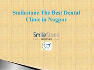 Smilestone the Best Dental Clinic in Nagpur
