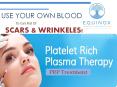 Platelet rich plasma prp treatment | Equinox PowerPoint PPT Presentation
