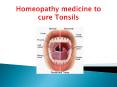Homeopathy medicine to cure Tonsils (1) PowerPoint PPT Presentation