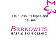 Causes of Hair Loss - Male Pattern Baldness