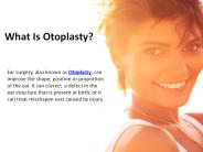 What Is Otoplasty?