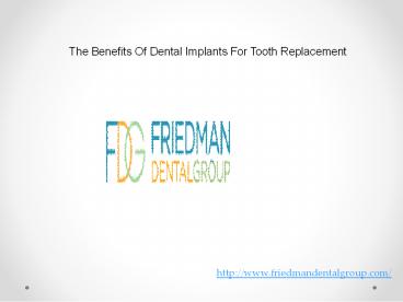 The Benefits Of Dental Implants For Tooth Replacement