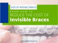Tips to Get Affordable Invisible Braces in Australia PowerPoint PPT Presentation