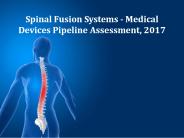 Spinal Fusion Systems - Medical Devices Pipeline Assessment, 2017