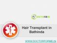 Hair Transplant in Bathinda