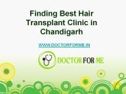 Hair Transplant in Chandigarh
