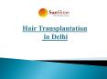 Hair Transplant in Delhi