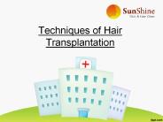 Techniques of Hair Transplant