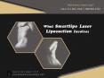 What Smartlipo Laser Liposuction Involves PowerPoint PPT Presentation