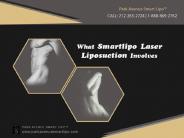 What Smartlipo Laser Liposuction Involves