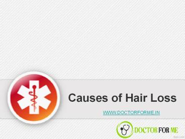 Causes of Hair Loss