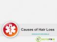 Causes of Hair Loss PowerPoint PPT Presentation