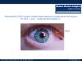 Analysis of Personalized LASIK Surgery Market applications and company’s active in the industry PowerPoint PPT Presentation