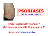 Psoriasis Homeopathic Treatment