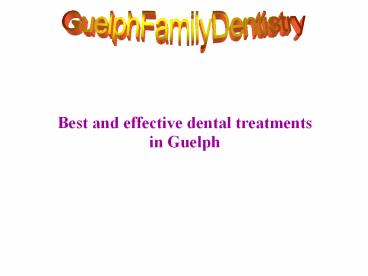 Best and effective dental treatments in Guelph