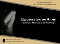Liposuction On Arms: Benefits Aftercare And Recovery PowerPoint PPT Presentation