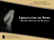 Liposuction On Arms: Benefits Aftercare And Recovery