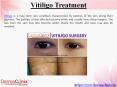Information About Vitiligo Treatment PowerPoint PPT Presentation