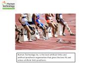 Prosthetic Limb Companies