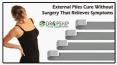 External Piles Cure without Surgery that Relieves Symptoms PowerPoint PPT Presentation