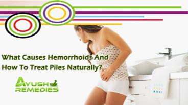 What Causes Hemorrhoids and How to Treat Piles Naturally?