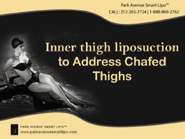 Inner Thigh Liposuction to Address Chafed Thighs