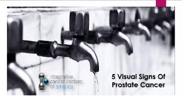 5 visual signs of prostate cancer