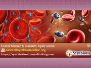 Journal of Cancer Science & Research