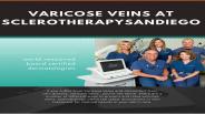 Treatment Of Spider Veins in San Diego