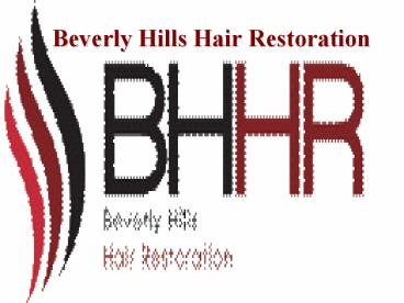 Best FUE hair transplant in beverly hills
