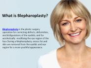 What is Blepharoplasty?
