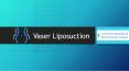 CCRS - Vaser Liposuction in Mumbai PowerPoint PPT Presentation