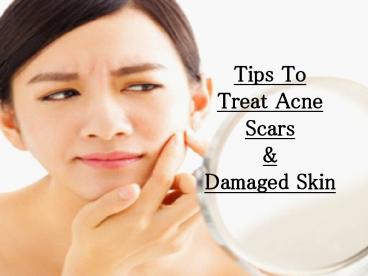 Tips To Treat Acne Scars & Damaged Skin
