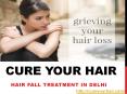 Hair fall Treatment in Delhi PowerPoint PPT Presentation