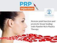 prp injection cost