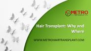 FUE-Why and Where- Metro