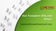 Hair Transplant: Why and Where PowerPoint PPT Presentation