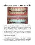 An Amateur’s Guide to Teeth Whitening PowerPoint PPT Presentation