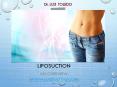 Liposuction Dubai PowerPoint PPT Presentation
