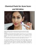 Chemical Peels for Acne Scars and Wrinkles PowerPoint PPT Presentation