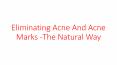 Eliminating Acne And Acne Marks The Natural Way PowerPoint PPT Presentation