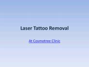 Tattoo Removal in Delhi