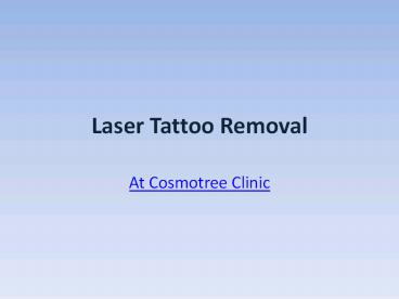 Tattoo Removal in Delhi (1)