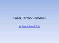 Tattoo Removal in Delhi (1) PowerPoint PPT Presentation