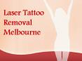 Laser Tattoo Removal Melbourne PowerPoint PPT Presentation