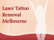 Laser Tattoo Removal Melbourne