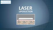 All About Laser Liposuction